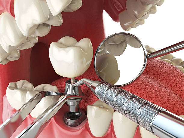 Best Emergency Broken Tooth Repair in Hazlehurst, GA